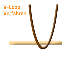 Schlingen Technik - V-loop Technik Toupet